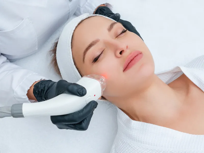 laser facial