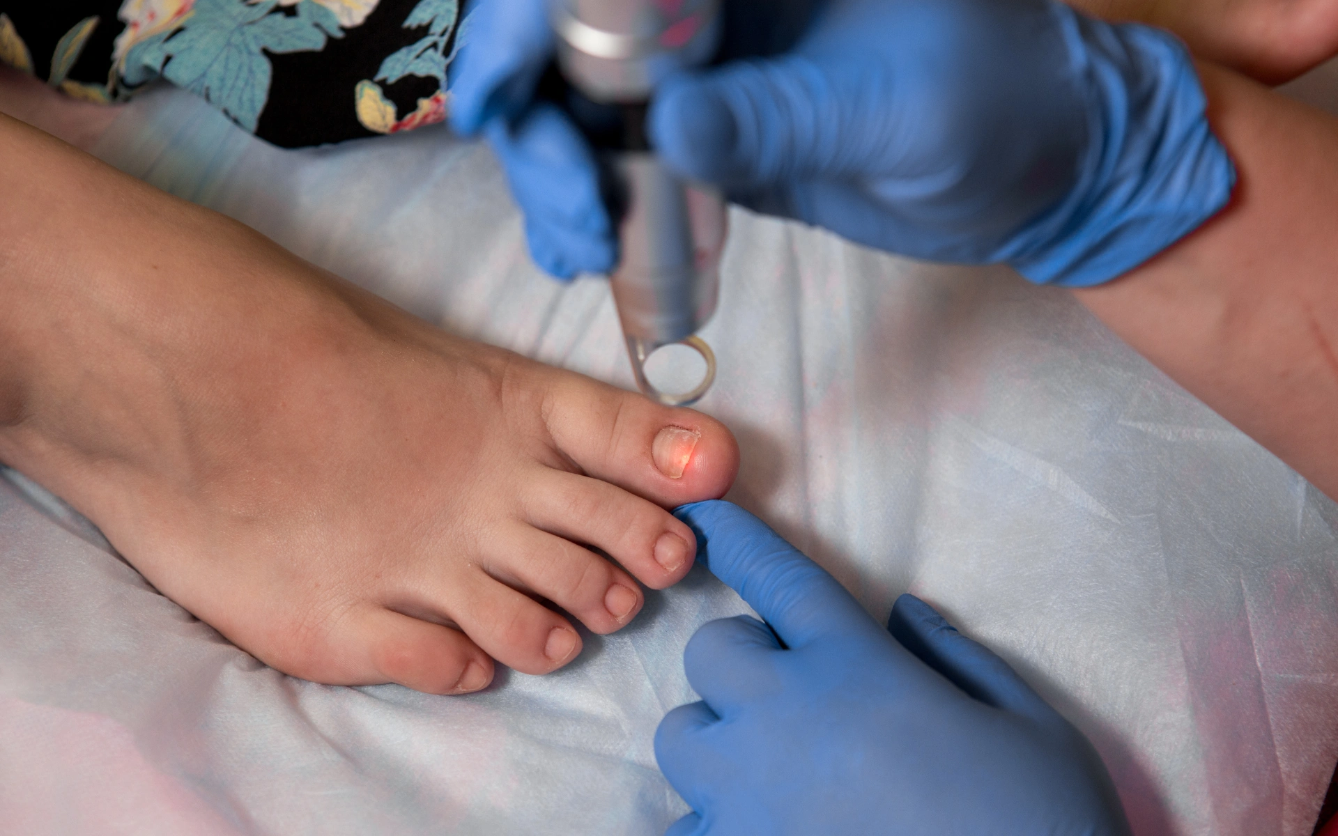 toenail fungus treatment in houston tx