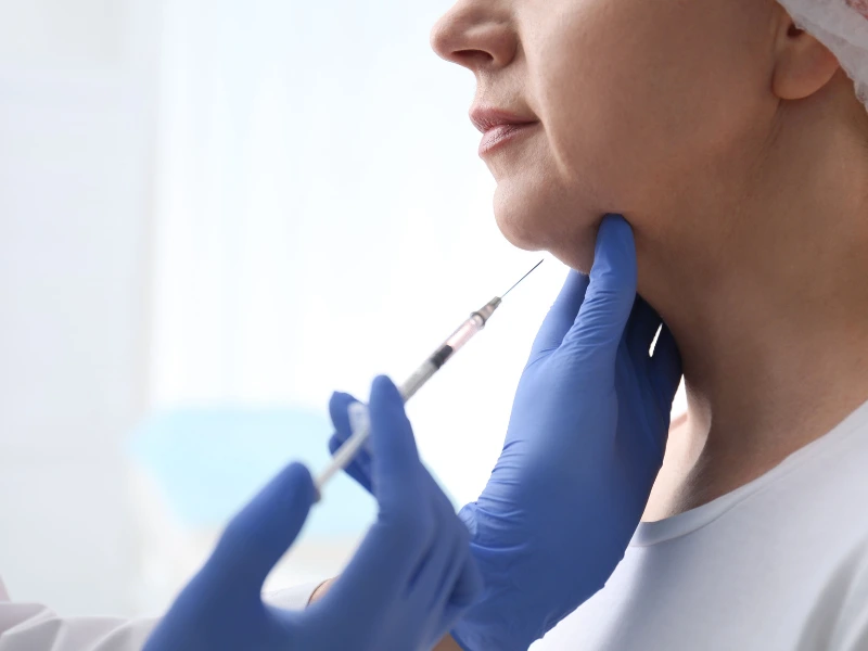 what is kybella