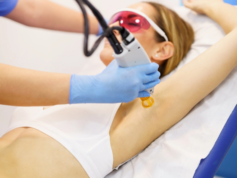 Areas We Treat With Laser Hair Removal