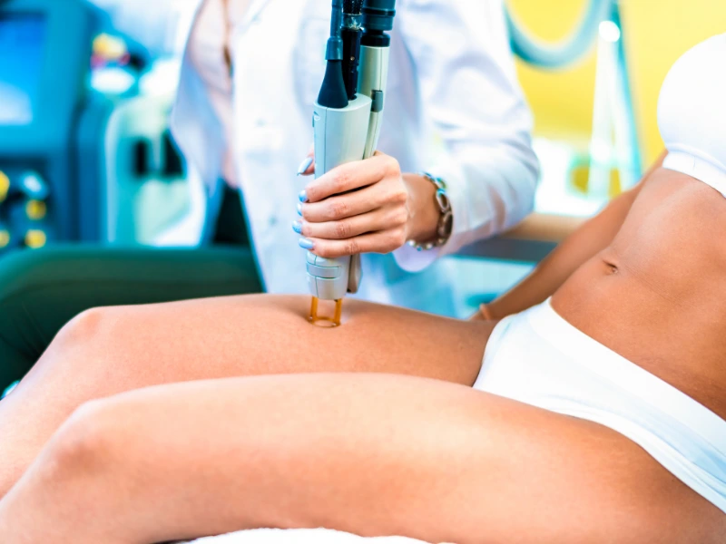 average cost for full body laser hair removal