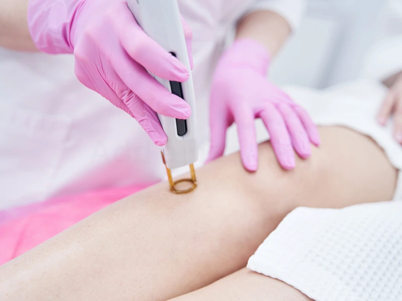 full body hair removal cost