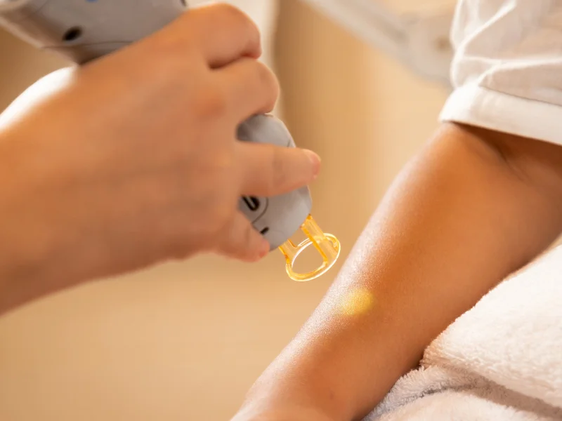 full body laser hair removal benefits