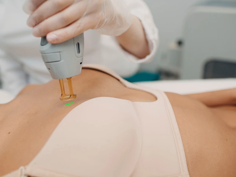 full body laser hair removal cost houston