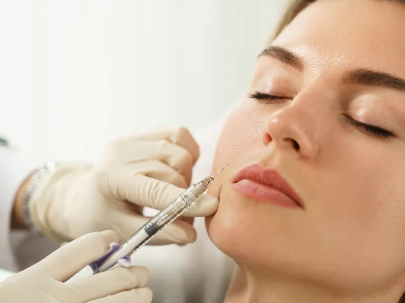 juvederm treatment