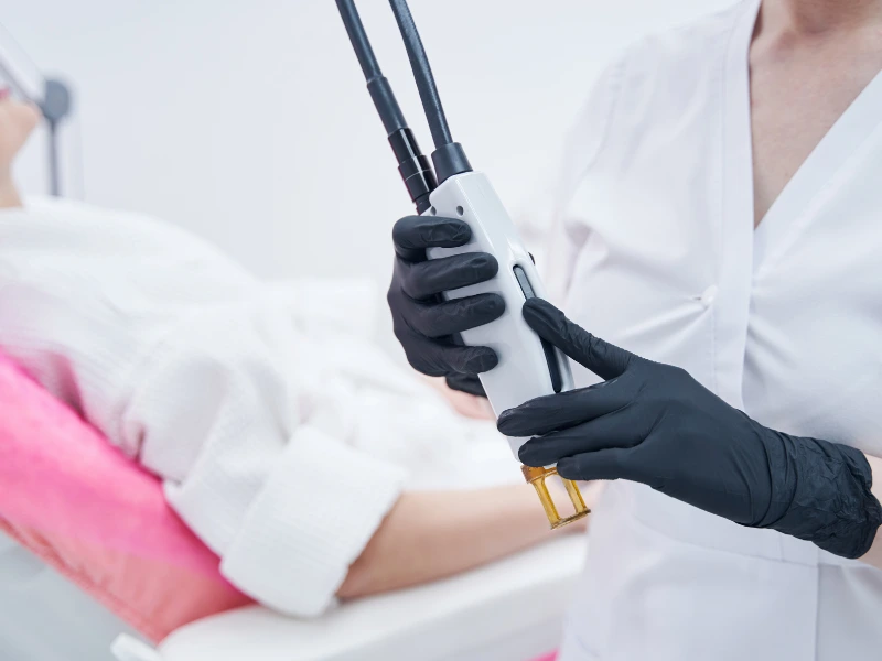 laser treatment for hair removal