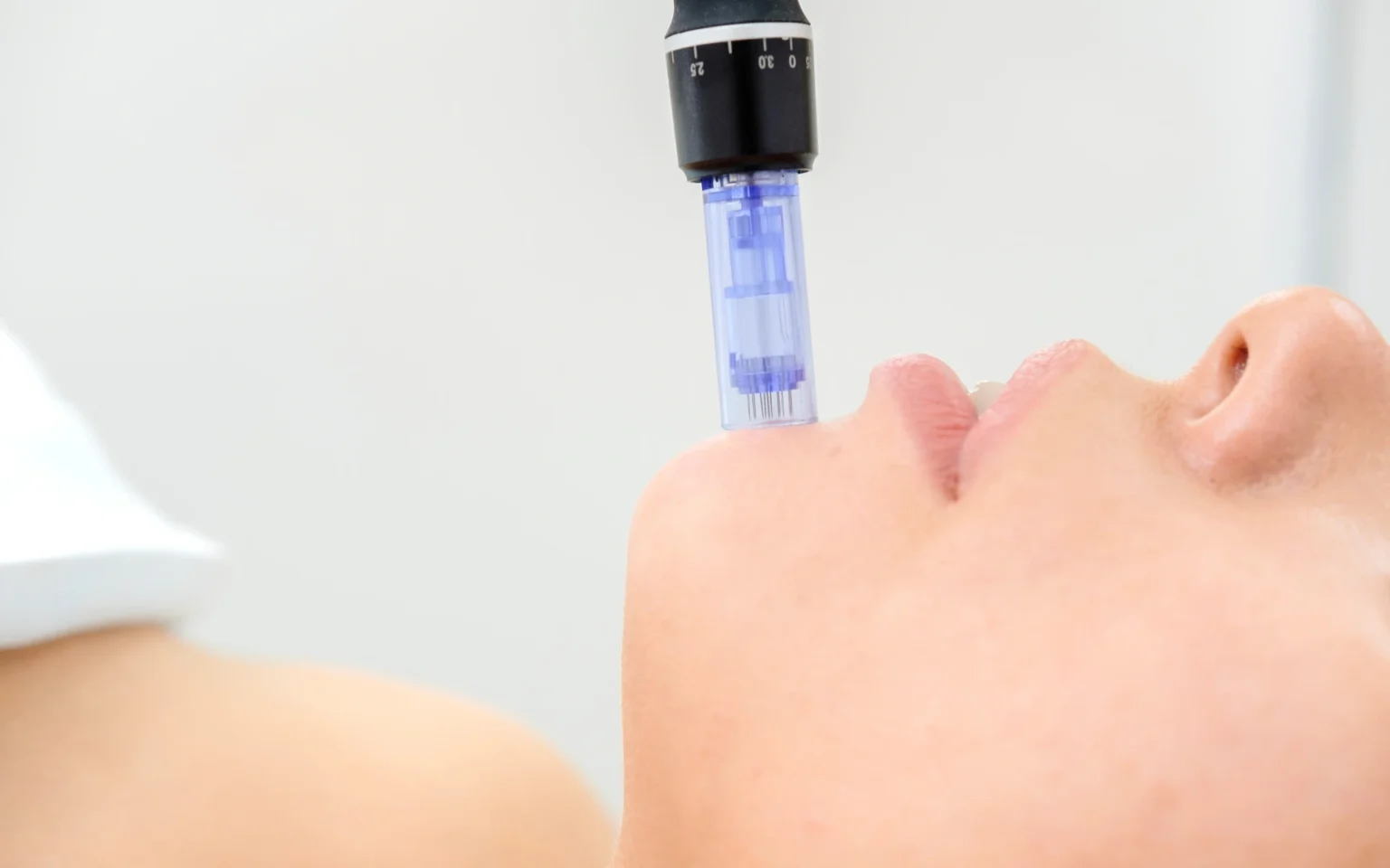 microneedling houston