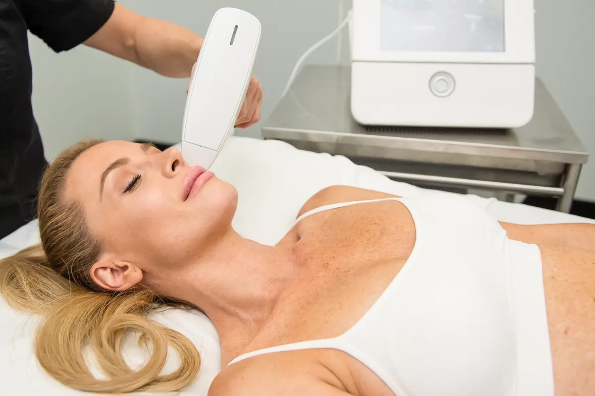 venus viva md skin resurfacing