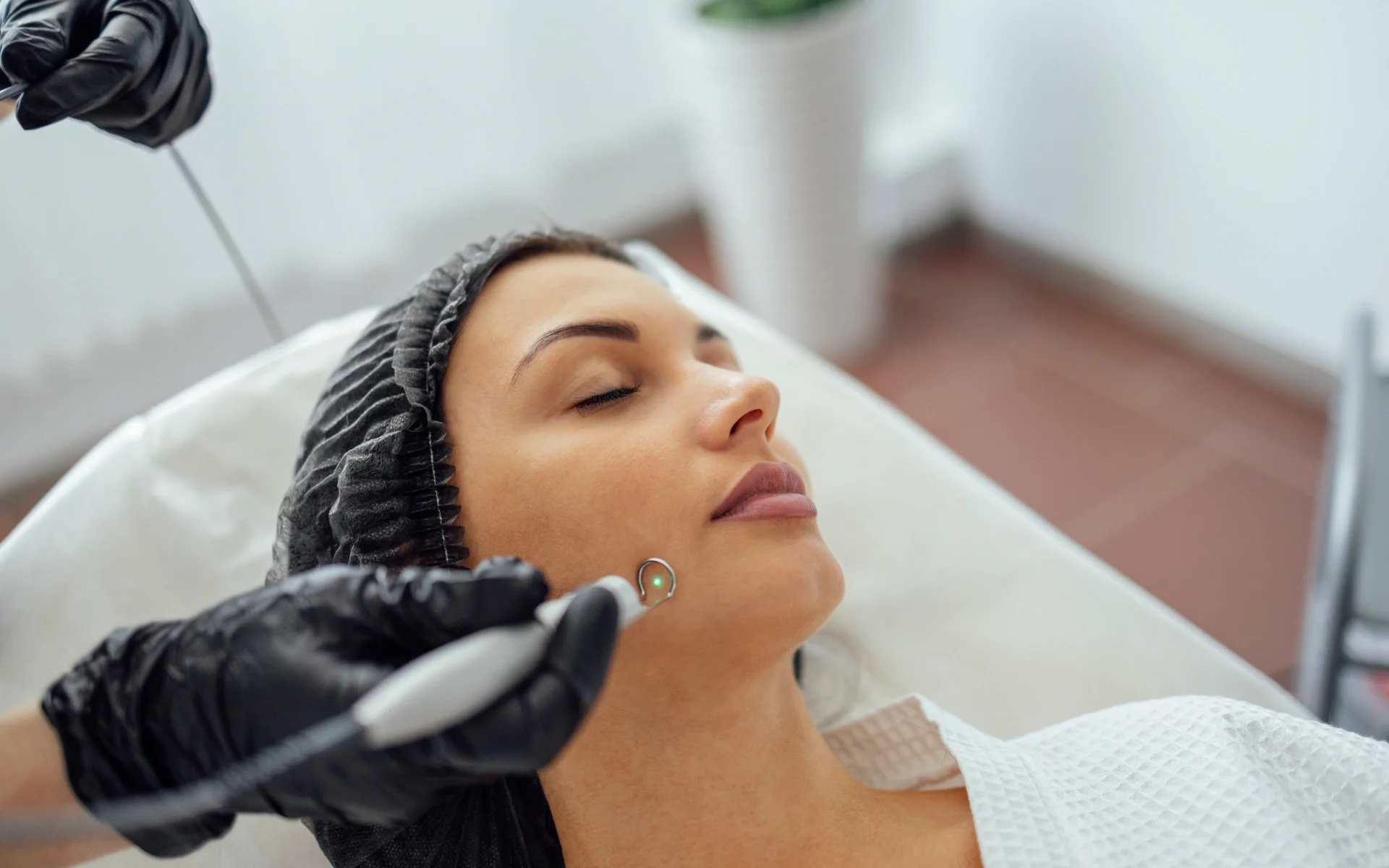 wart removal