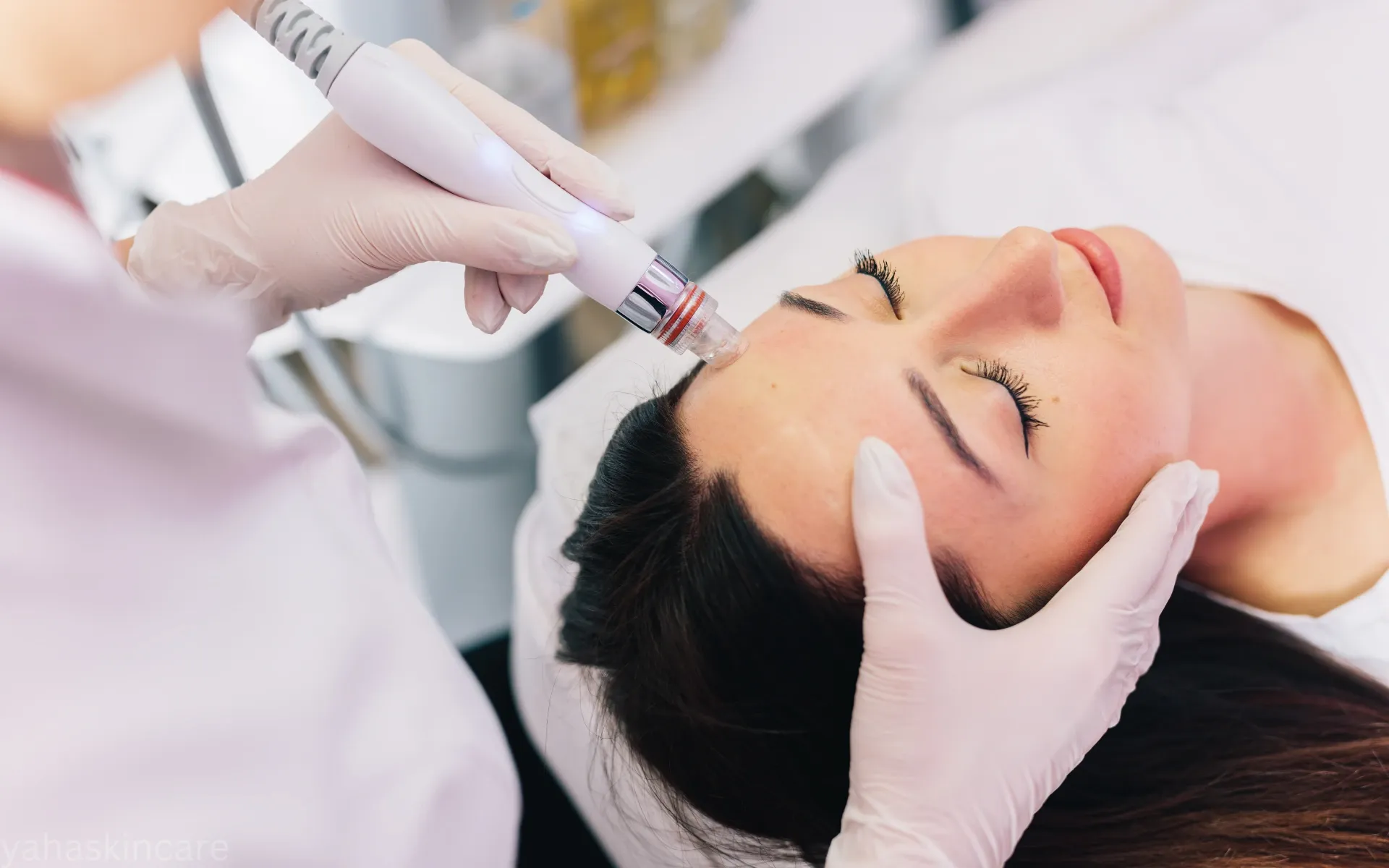 hydrafacial benefits