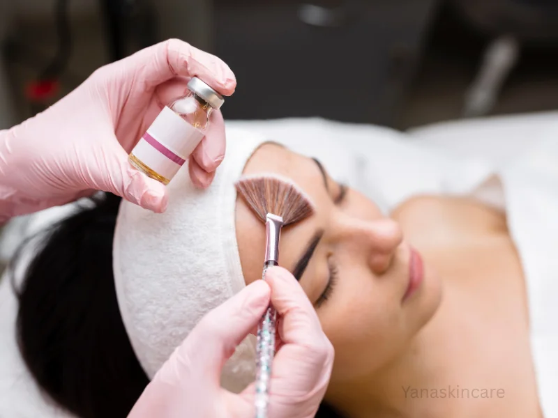 chemical peel or hydrafacial