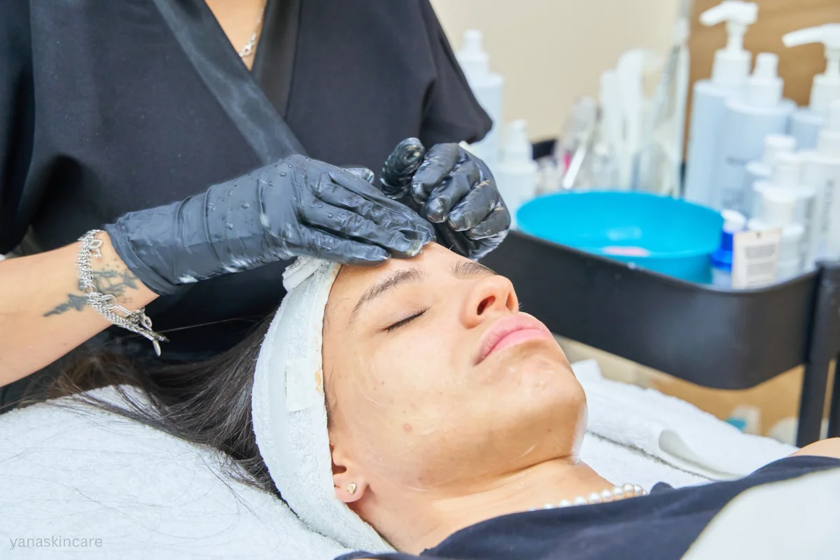 hydrafacial recovery time