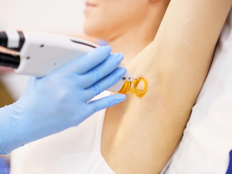 lightening underarms​