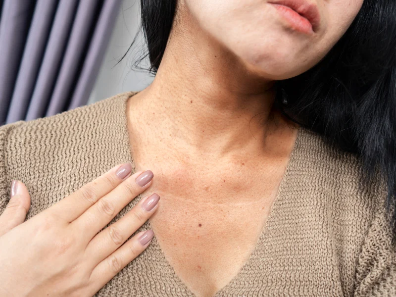 neck skin tag