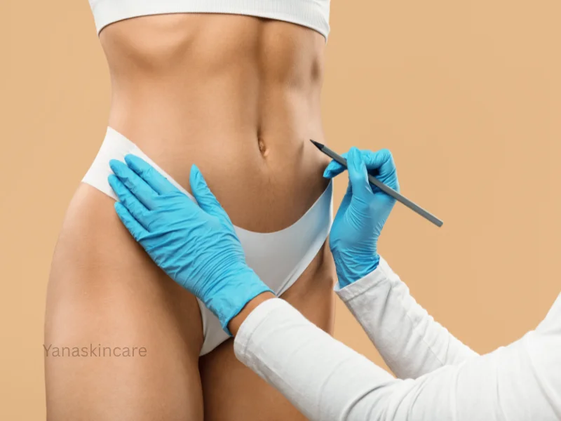 non surgical vaginal rejuvenation cost