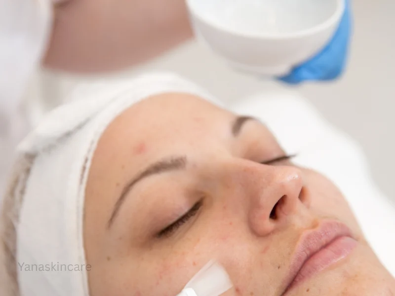 peeling after hydrafacial