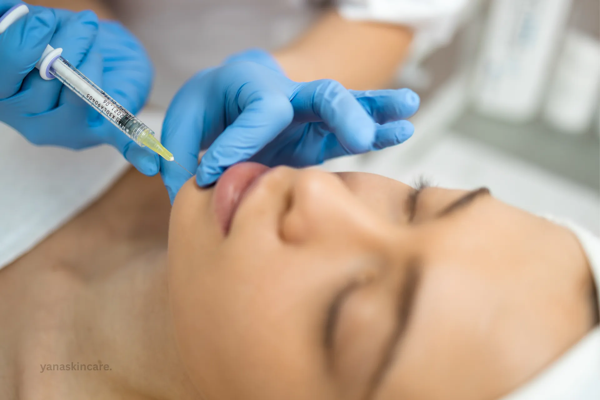 How long does juvederm last​