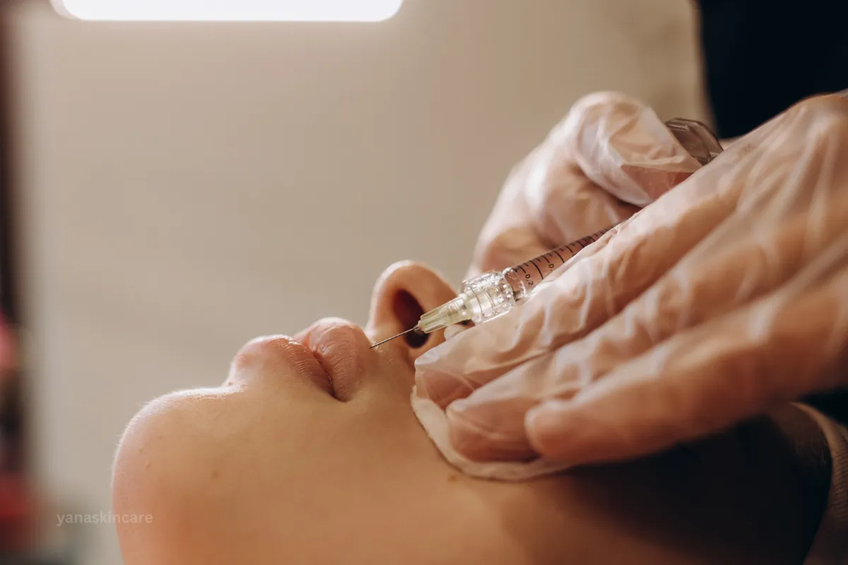 Reversibility of Dermal Fillers