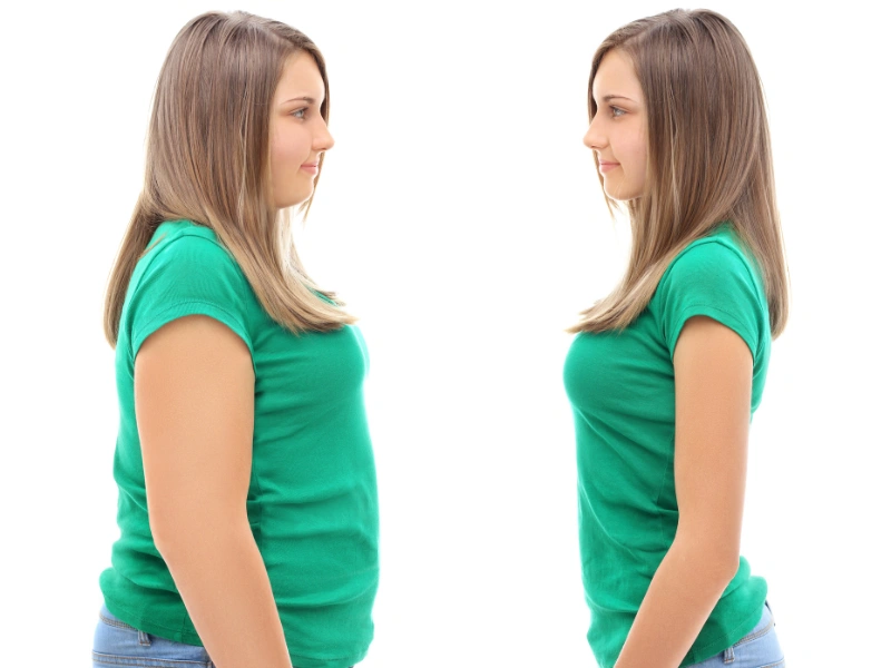 before and after weight loss programs houston
