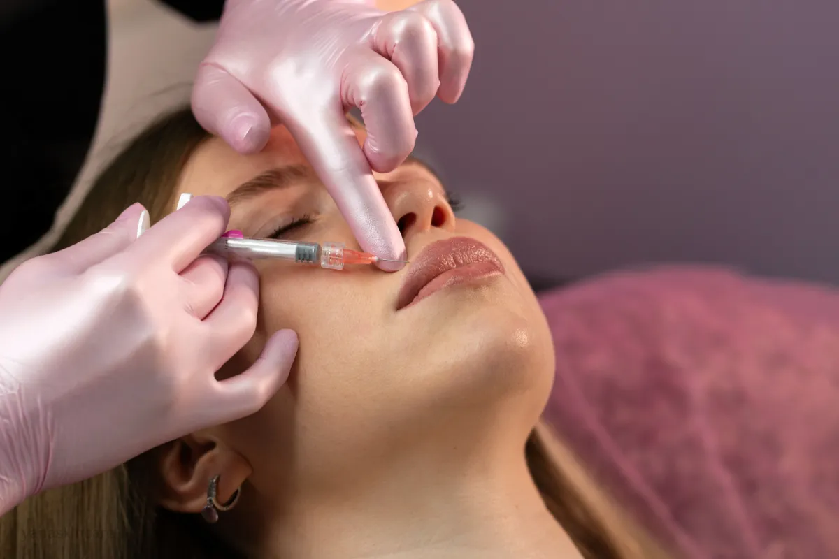 benefits of dermal fillers for marionette lines