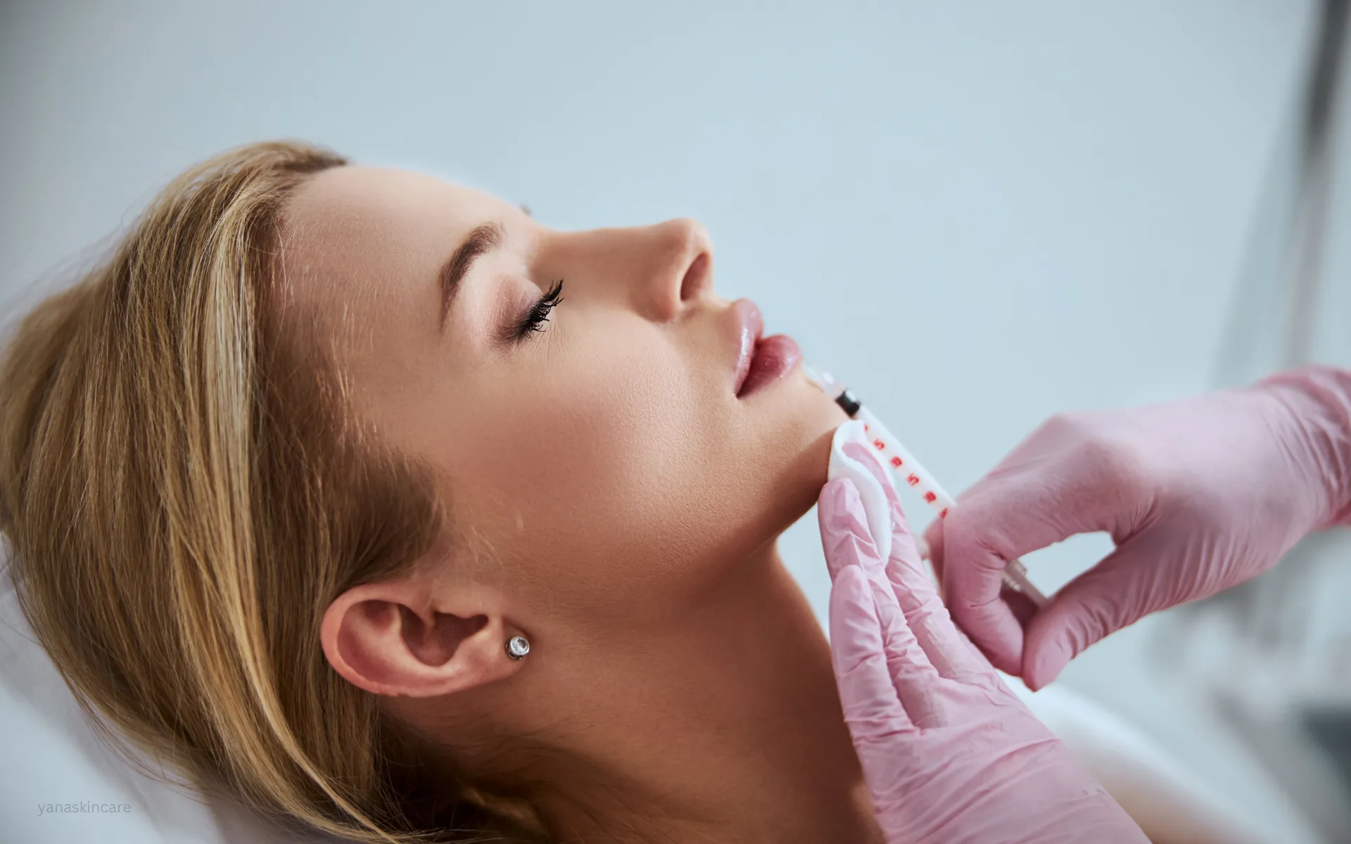 dermal filler for jawline