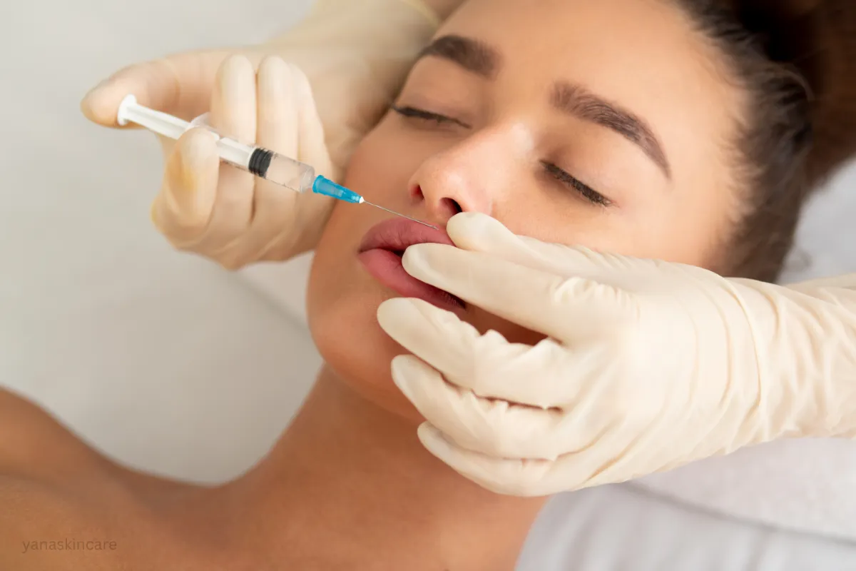 marionette lines treatment cost