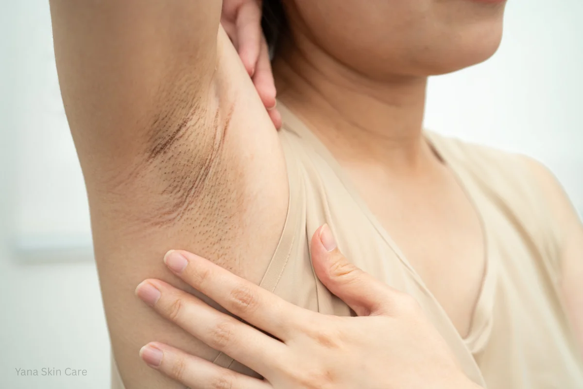 refresh your skin with underarm lightening