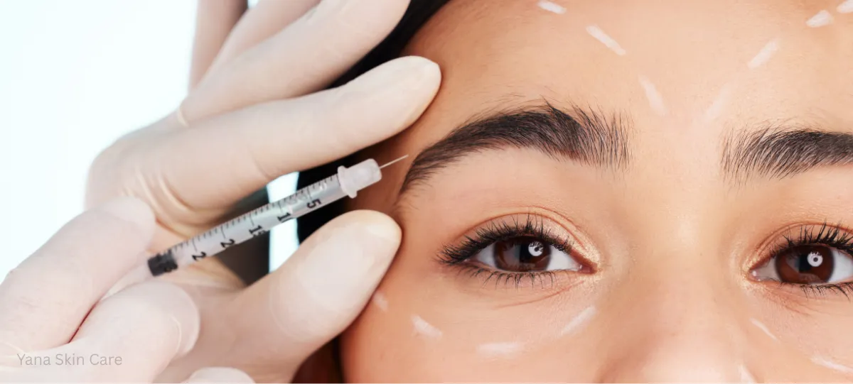 what is an under eye filler