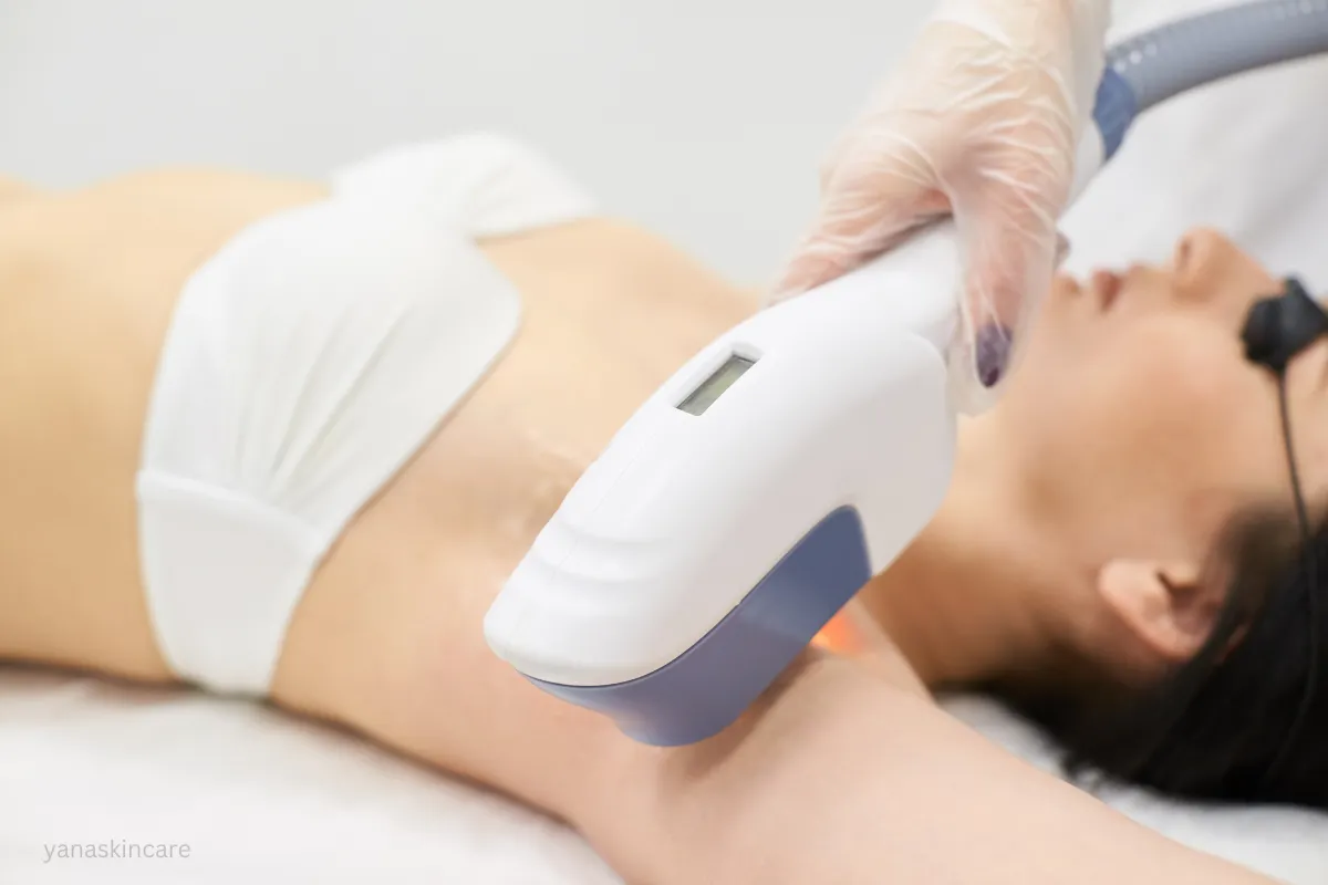 brazilian laser hair removal price