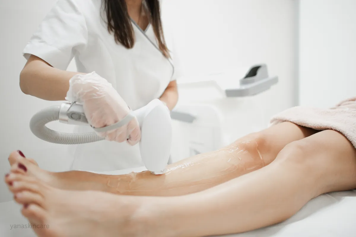 brazilian laser hair removal