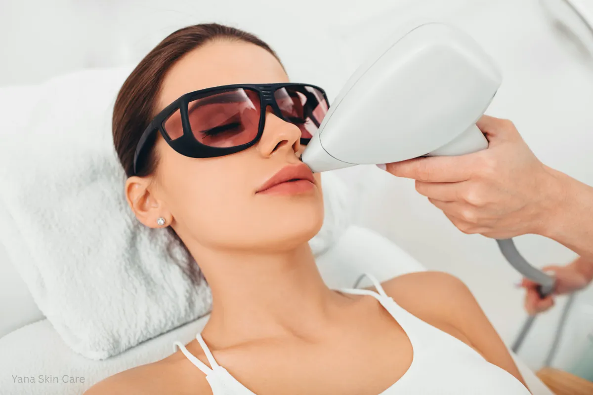 facial before or after laser hair removal