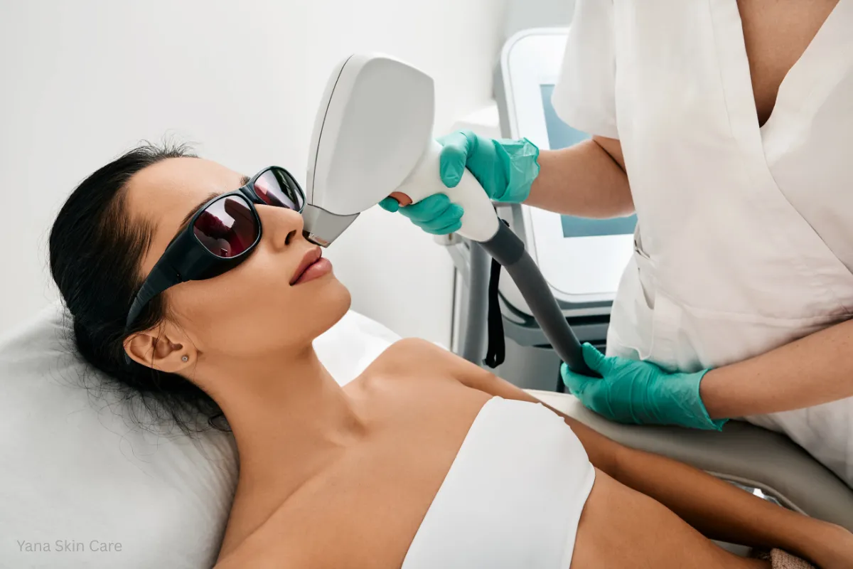 facial laser hair removal cost