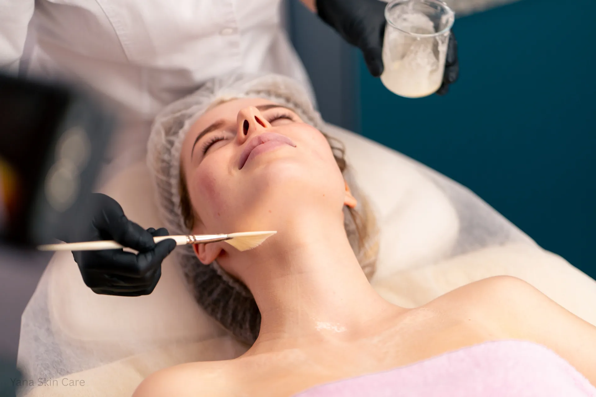 how much is a vi peel