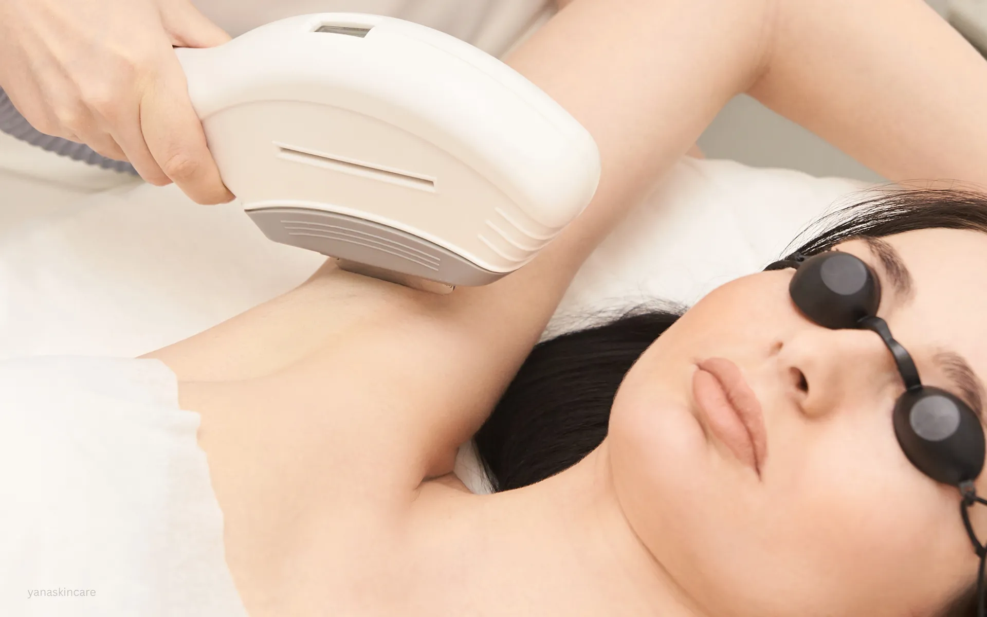 ipl vs laser hair removal