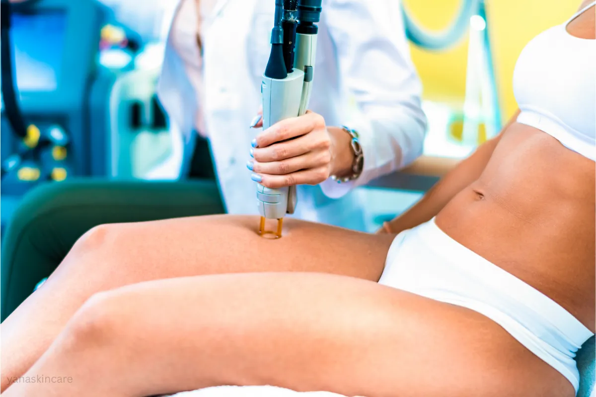 laser hair removal schedule