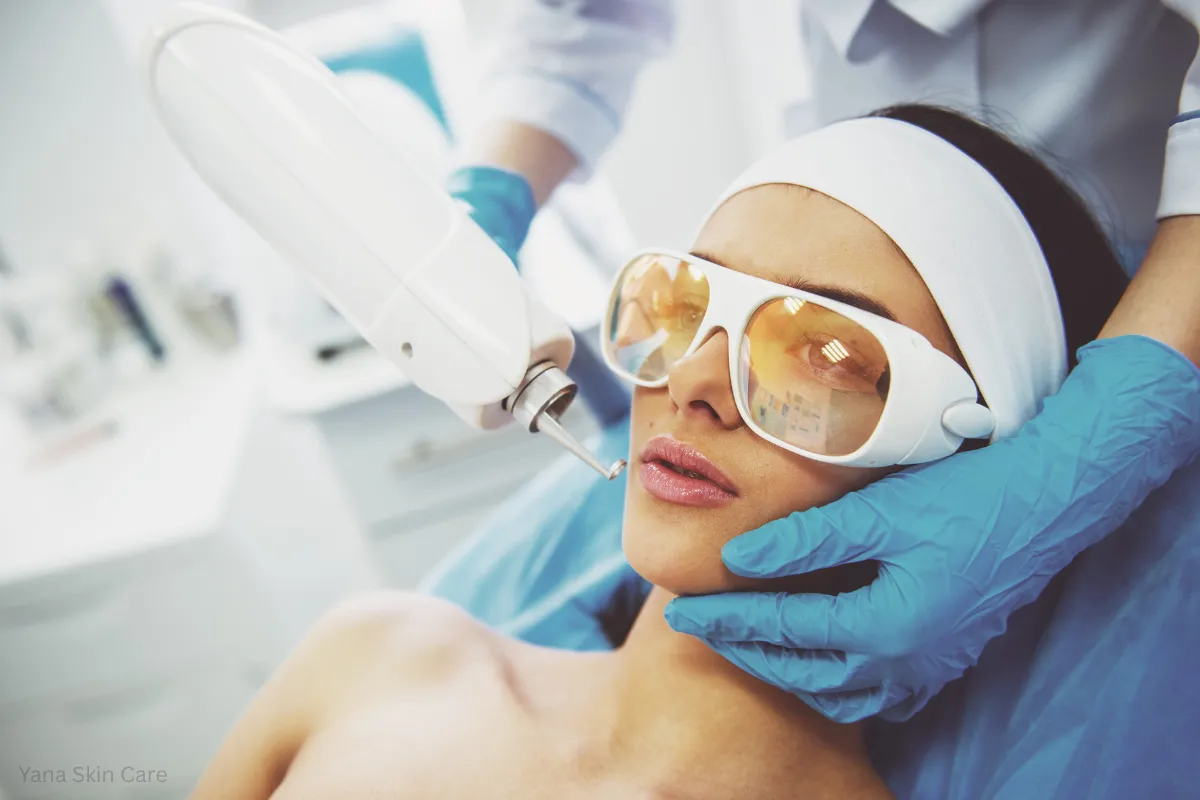 cost of laser hair removal on face