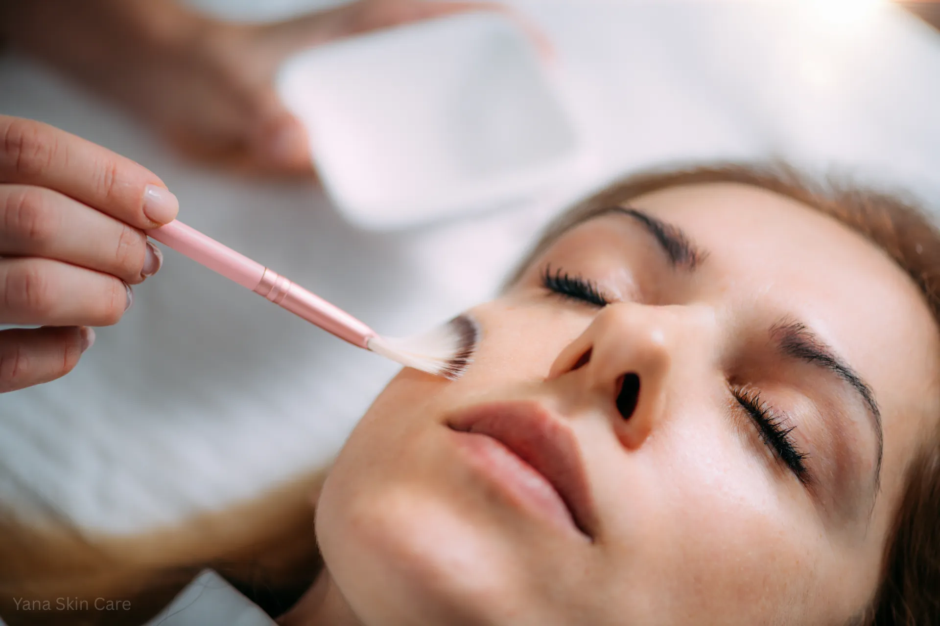 do chemical peels hurt​​