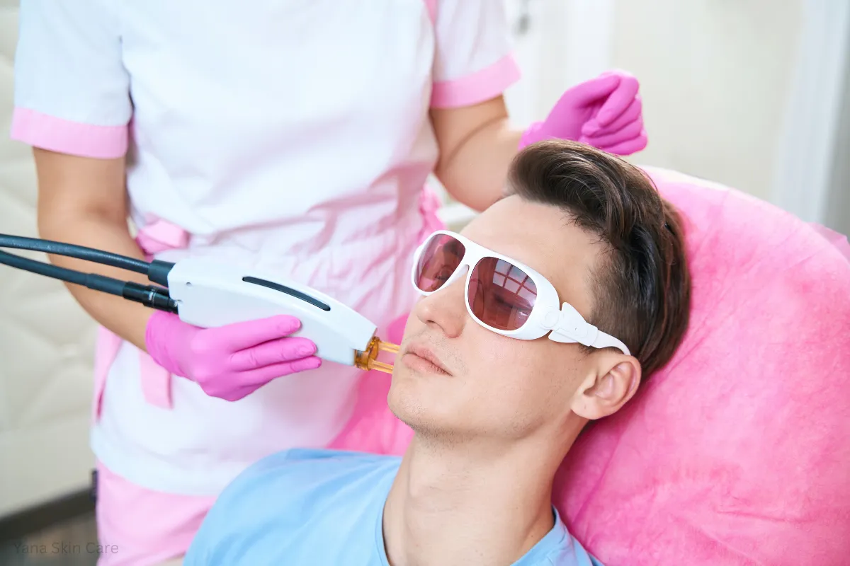 face laser hair removal price