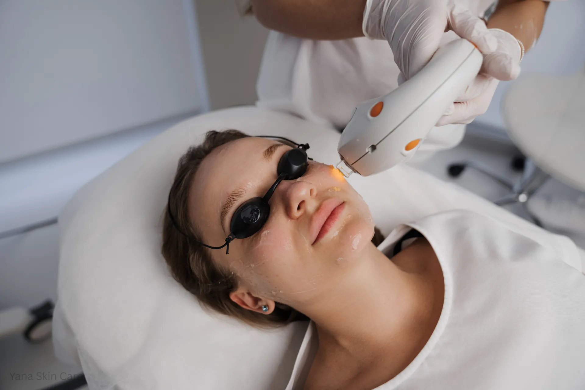 facial laser hair removal cost