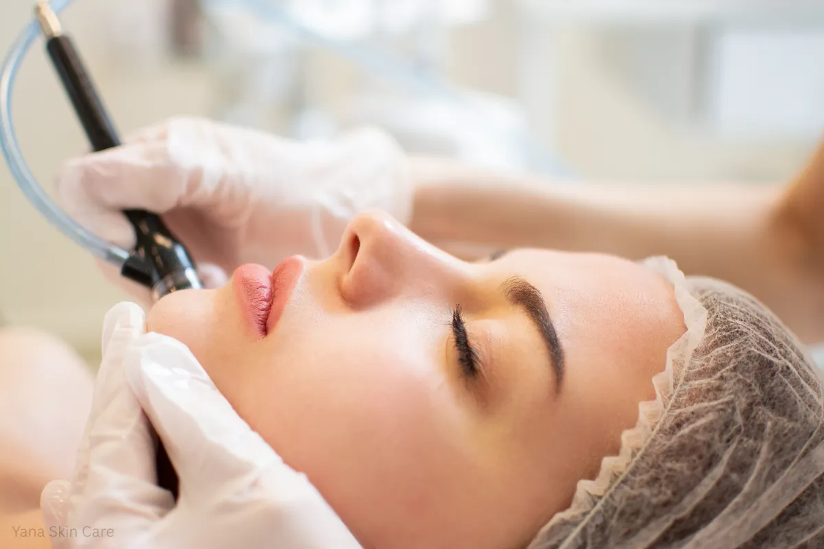hydrafacial for acne scars