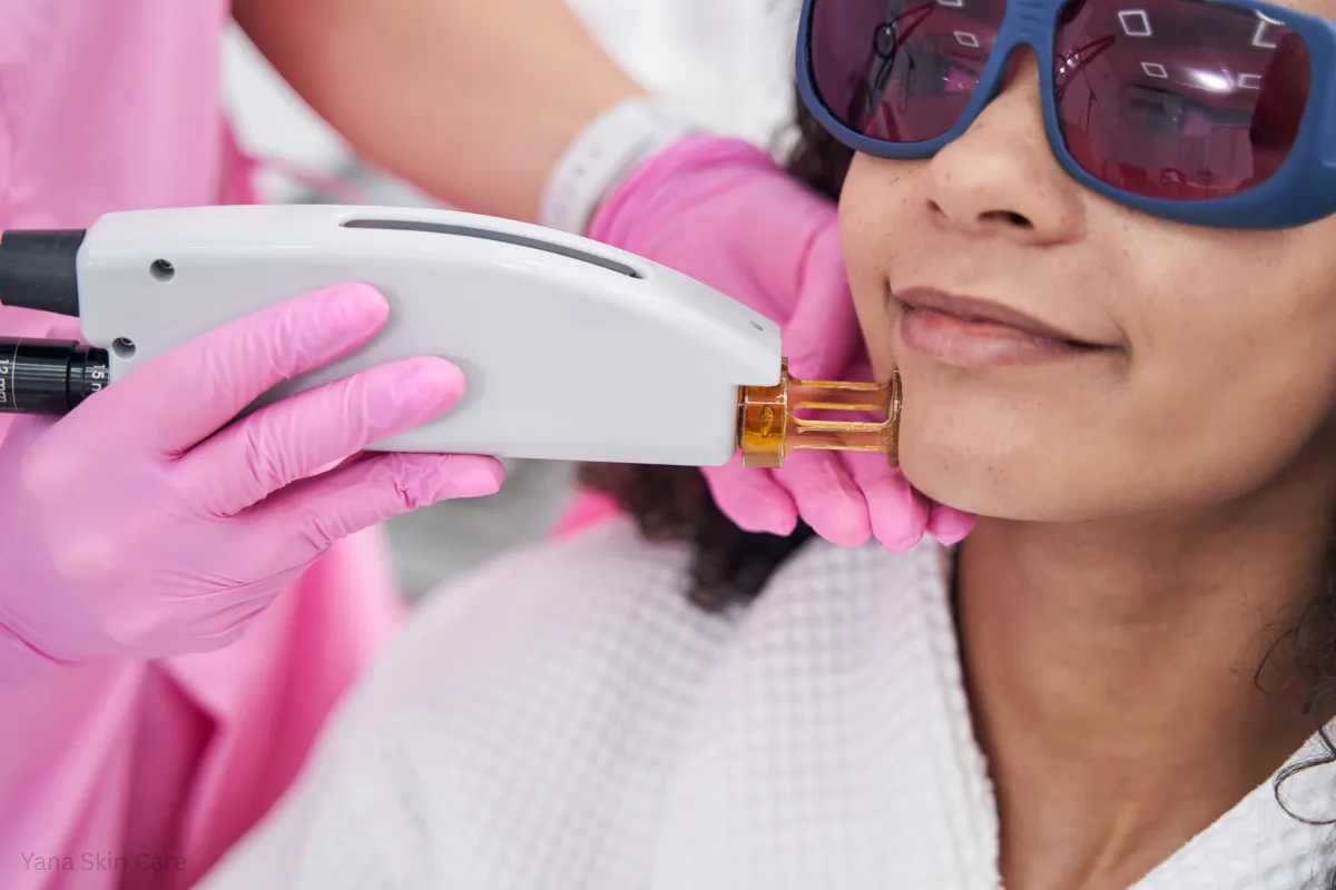 laser hair removal cost on face