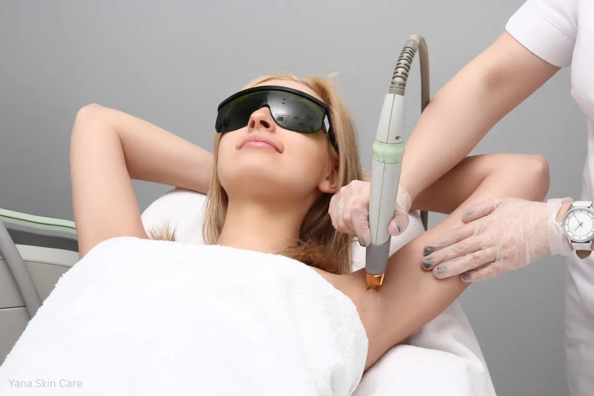 laser treatment for underarms cost