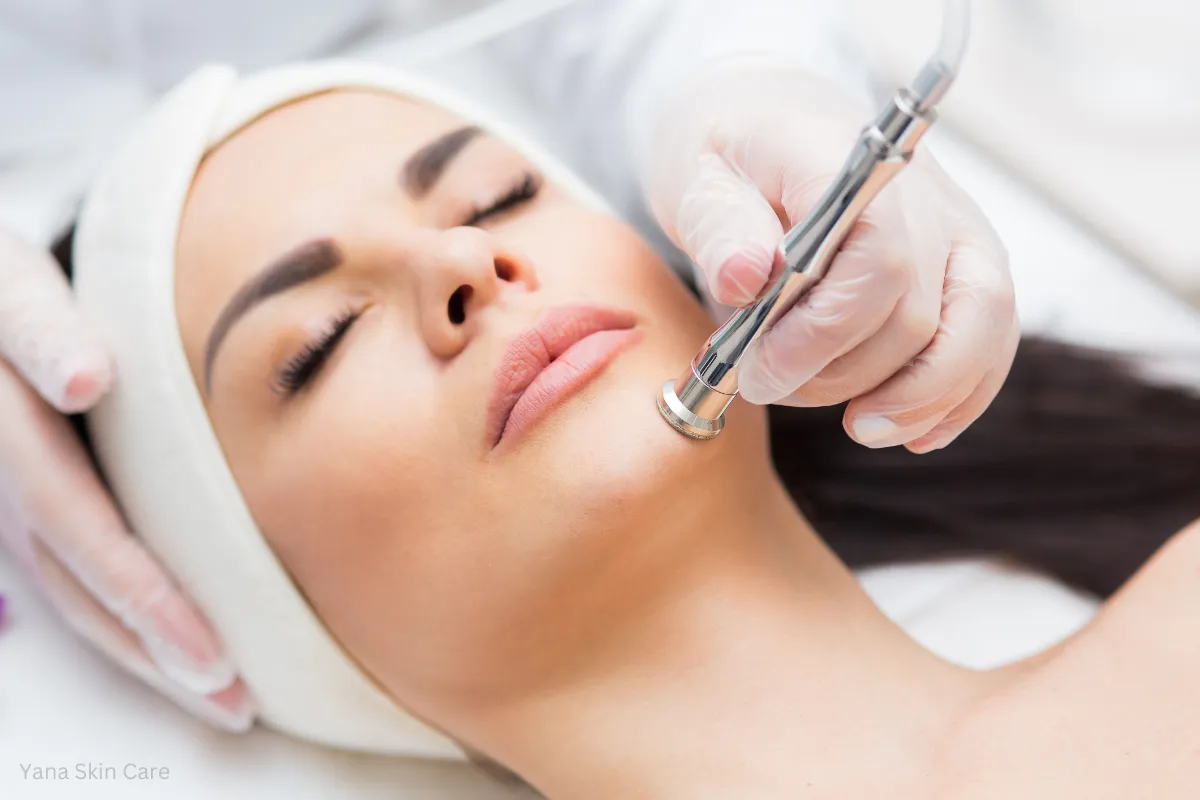 microdermabrasion treatment