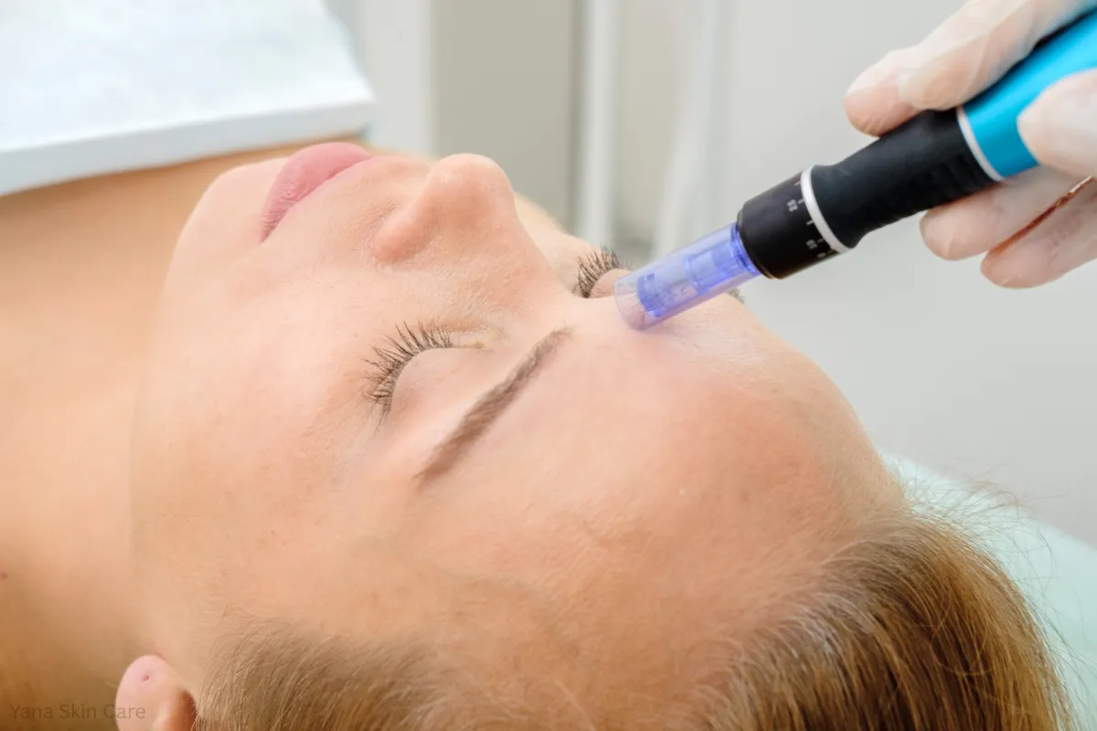 microneedling vs rf microneedling cost