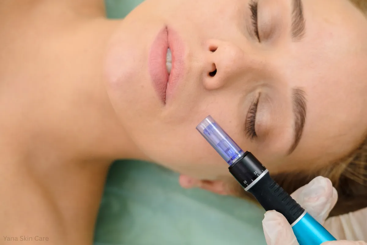 rf microneedling vs microneedling collagen elastin