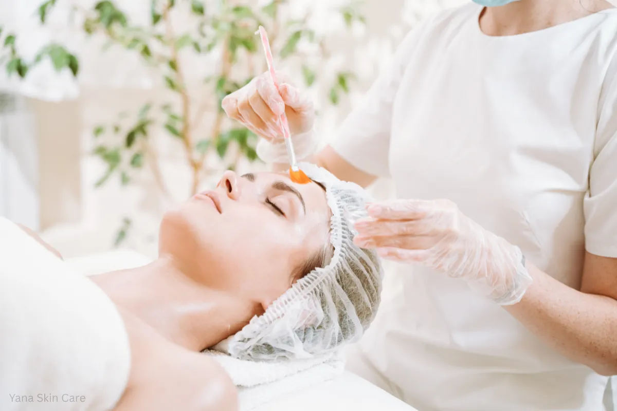 understanding chemical peels