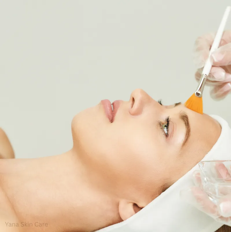 what is microdermabrasion