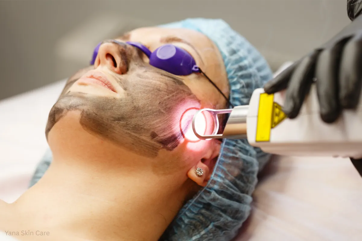 why clients love laser genesis