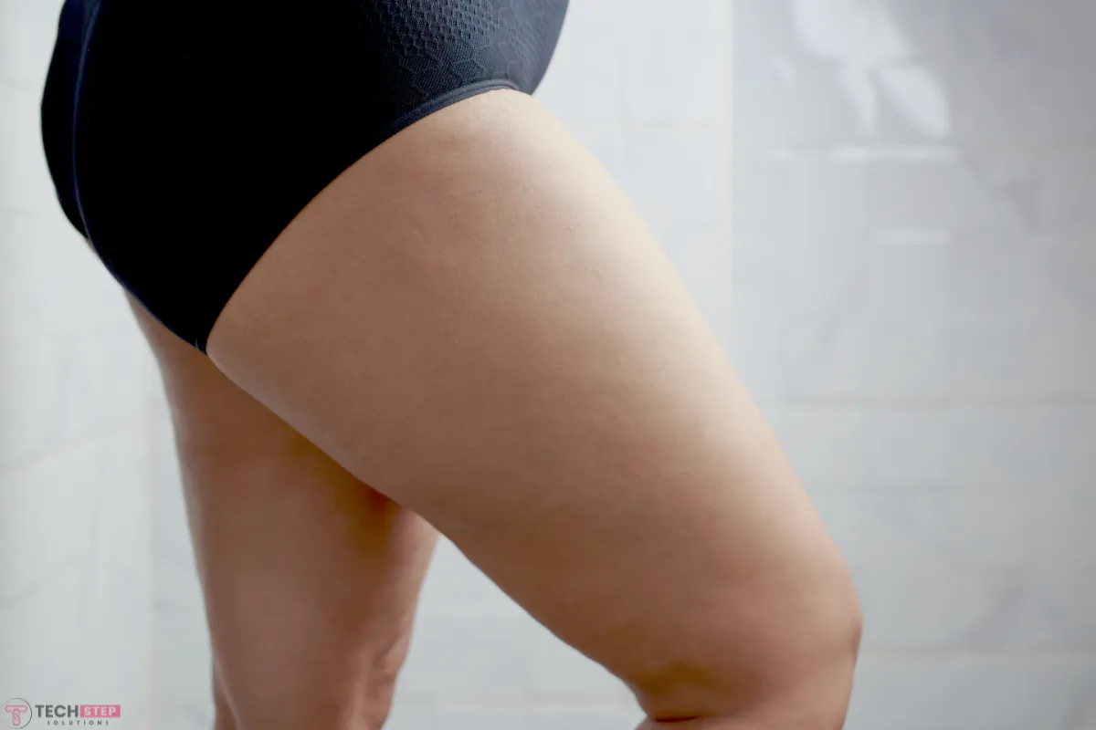 Inner Thigh Bleaching Houston tx