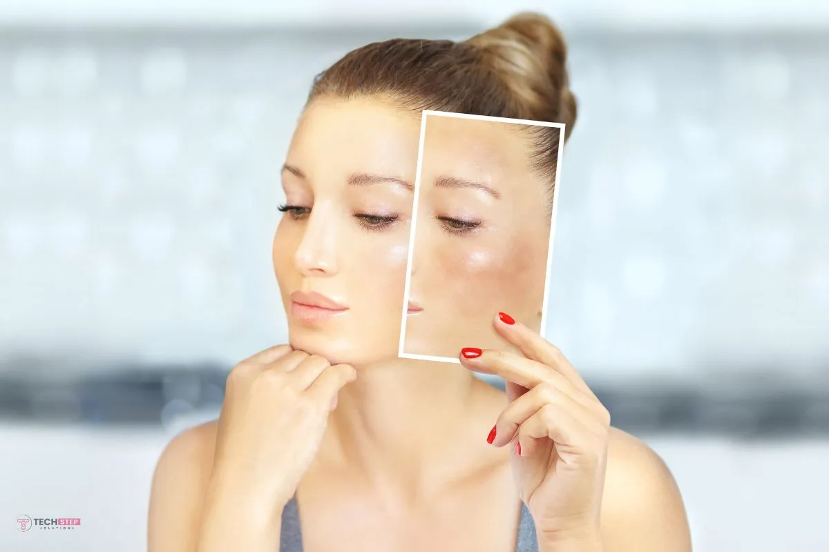 Benefits of Hyperpigmentation Treatment At Yana Skin Care